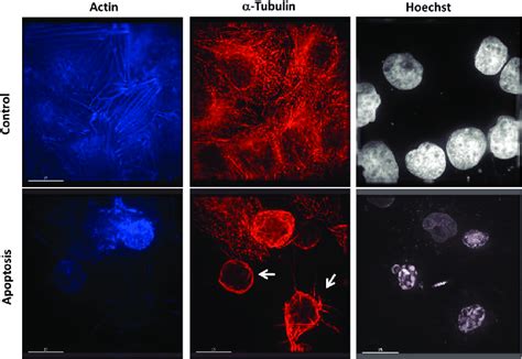 Immunofluorescence Microscopy Image Of Control And Apoptotic Cells In