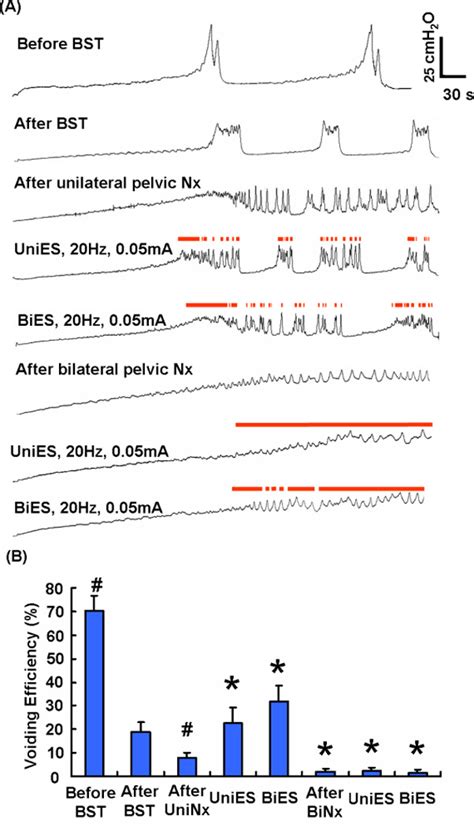 Bilateral Pudendal Afferent Stimulation Improves Bladder Emptying In