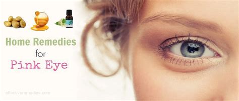 30 Natural Home Remedies for Pink Eye Relief in Adults & Children