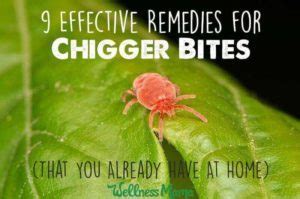 Proven Natural Remedies for Chigger Bites (& How to Avoid)