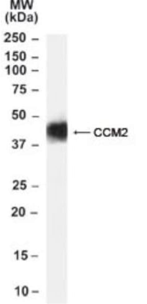 CCM2 Antibody Novus Biologicals 0 1mg Unlabeled Fisher Scientific