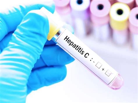 Hepatitis C en menores Cofepris autoriza medicamento huérfano IMER