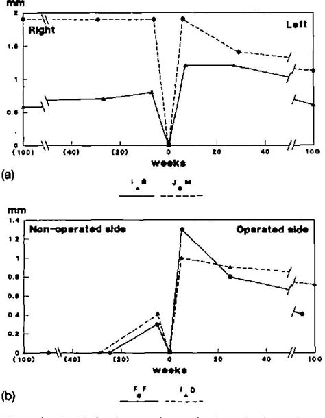 Figure 8 From Unilateral And Bilateral Corticotomies For Correction Of