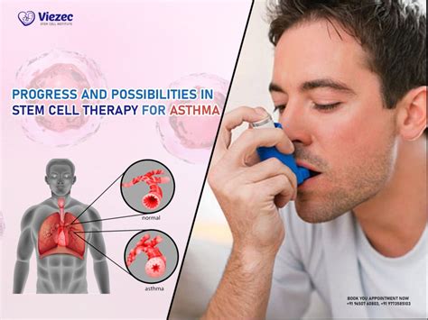 Progress And Possibilities In Stem Cell Therapy For Asthma