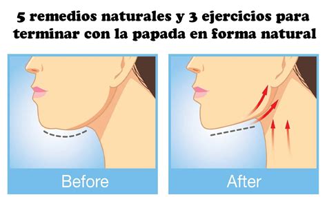 5 Remedios Naturales Y 3 Ejercicios Para Terminar Con La Papada En Forma Natural