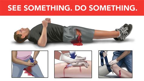 Uab Surgeons Explain Stop The Bleed Initiative And Why More Kits Are Needed News Uab