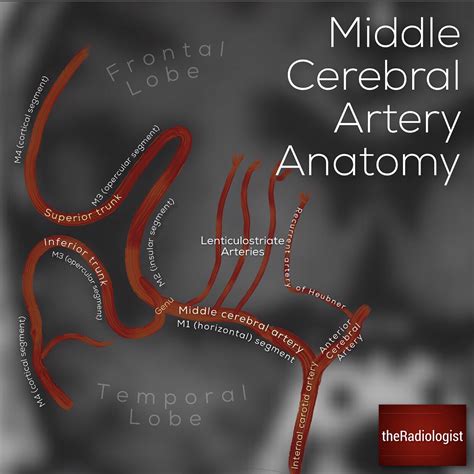 Middle Cerebral Artery Mri