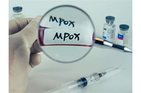 Mpox Is Still Circulating Among Us Gay Men Report Warns