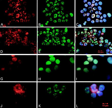 Immunofluorescent Staining For Topo Ii A D G And J Histones B E