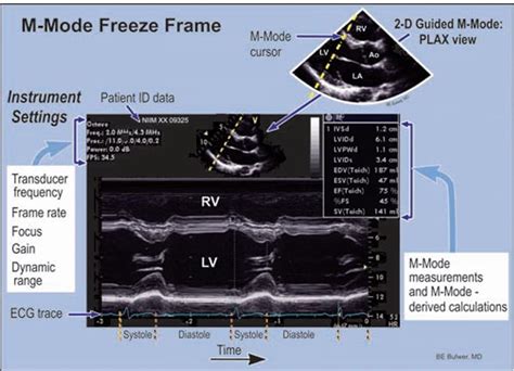 Cardiac Pet Scan Protocol | Pets Animals US