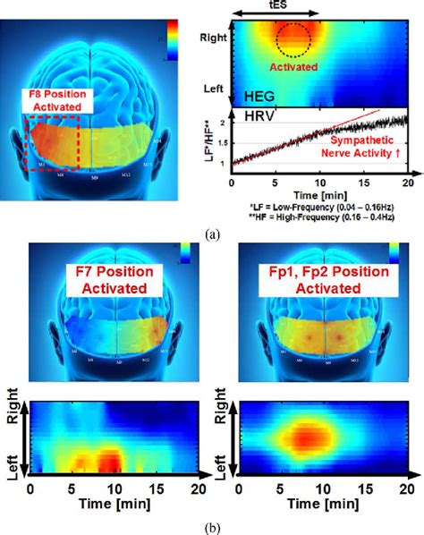 Figure From A Wearable Eeg Heg Hrv Multimodal System With