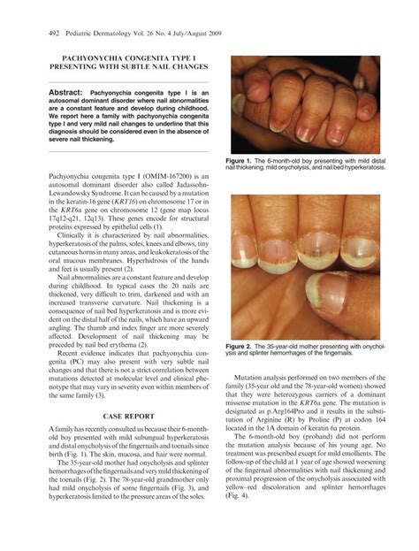 PDF Pachyonychia Congenita Type I Presenting With Subtle Nail Changes