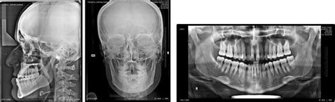 Pre Treatment Radiographs Download Scientific Diagram