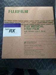 Fuji Medical X Ray Film At Rs 1900 Pack Laser Imaging Film In Kanpur