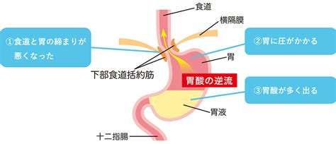 逆流性食道炎 銀座泰明クリニック