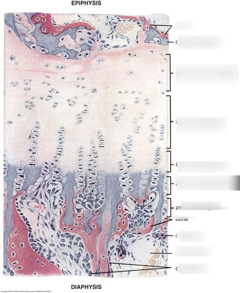 Msk Week Ch Bone Ii Image Endochondral Bone Formation