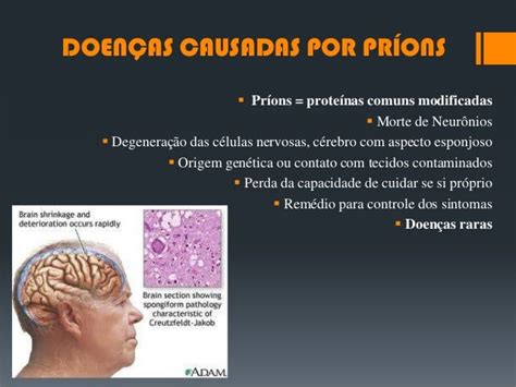 Doenças Neurodegenerativas