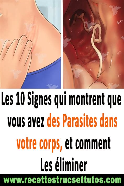 Les Signes Qui Montrent Que Vous Avez Des Parasites Dans Votre Corps