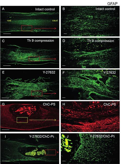 Representative Images Showing Activation Of Gfap Immunostained