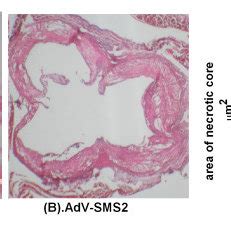 AdV SMS2 Administration Increases Atherosclerotic Lesions In The Aorta