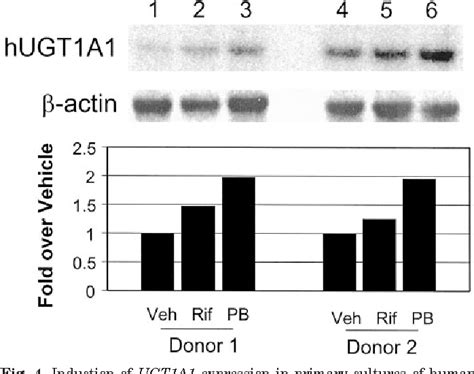 Constitutive Androstane Receptor Semantic Scholar