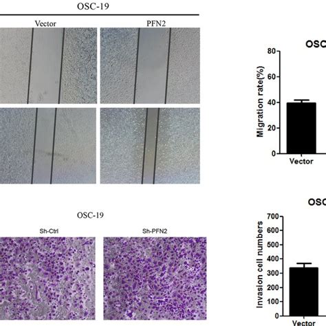 Pfn2 Overexpression Promoted Cell Migration And Invasion A Cell