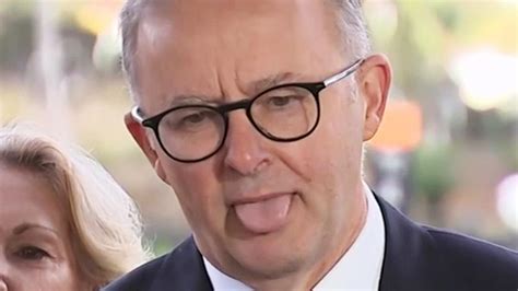 Federal Election Anthony Albanese Mistake Explained On Cash