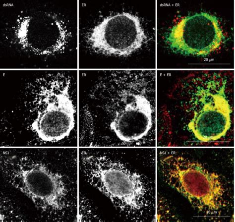 Localization Of West Nile Virus Dsrna Structural And Non Structural Download Scientific