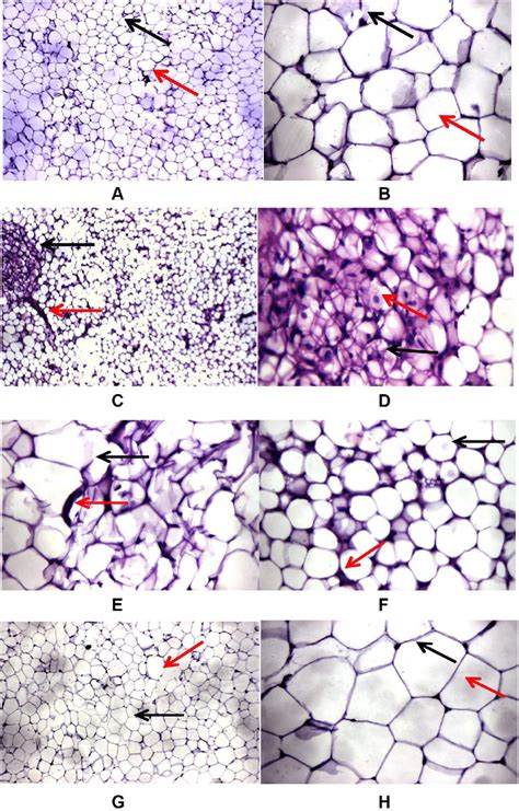 Effects Of Dg On Hfd Induced Histopathological Changes In Adipose