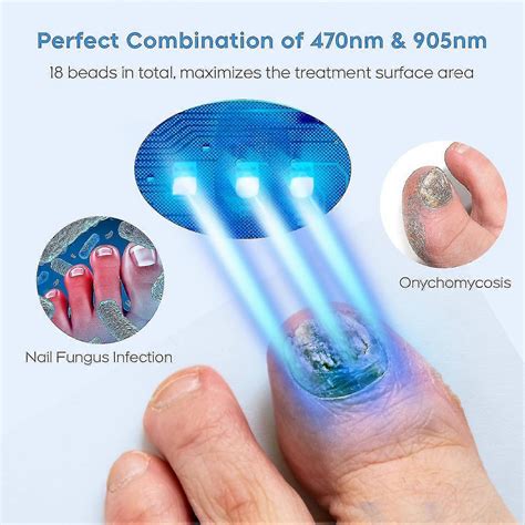 Nail Fungus Laser Treatment Device for Multiple Toenail, Home Use 905nm