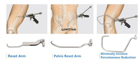 Orthopedic Collinear Reduction Clamp Instrument Set Surgical Instrument