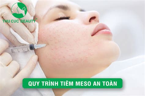 Quy Trình Tiêm Meso đạt Chuẩn Y Khoa