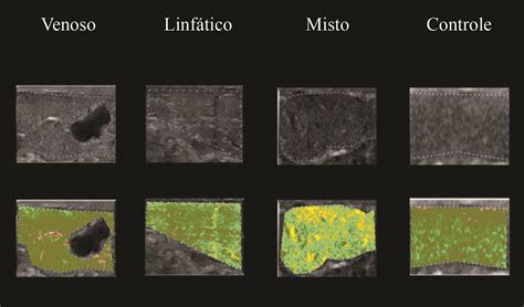 Scielo Brasil Uso De Software Na Imagem Ultrassonogr Fica Para