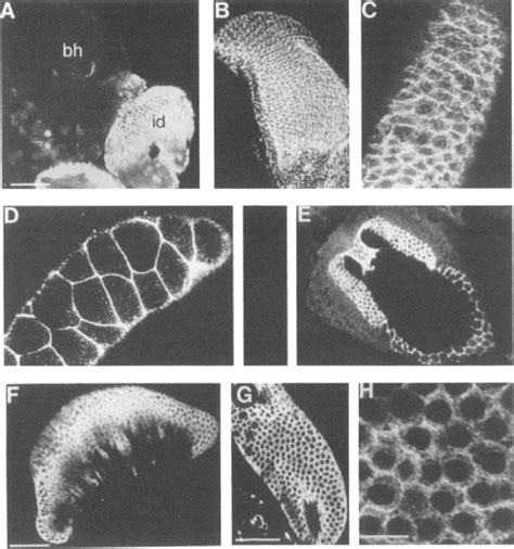 Figure 3 From The Drosophila Lethal 2 Giant Larvae Tumor Suppressor