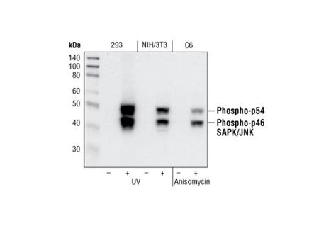 Phospho SAPK JNK Thr183 Tyr185 81E11 Rabbit mAb 20 µl 基因商城