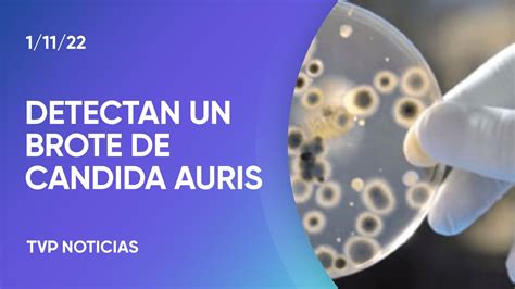 Detectan El Primer Brote De Candida Auris En El Pa S Youtube