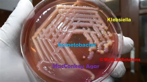 Acinetobacter And Klebsiella Growth On Macconkey Agar Demonstration