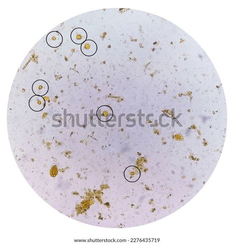 Blastocystis Hominis Histology