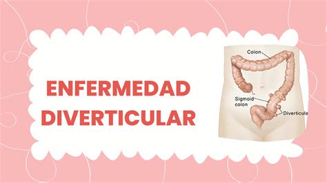 SOLUTION Enfermedad Diverticular Studypool