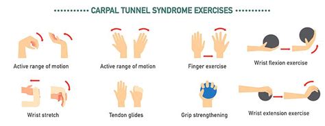 Carpal Tunnel Syndrome Stretches