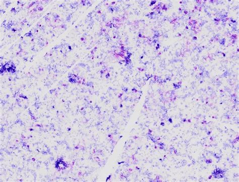 Pneumocystis Jirovecii Microscopy Controllab