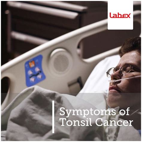 What are the symptoms of tonsil cancer? - Labex Electrolarynx - Medium