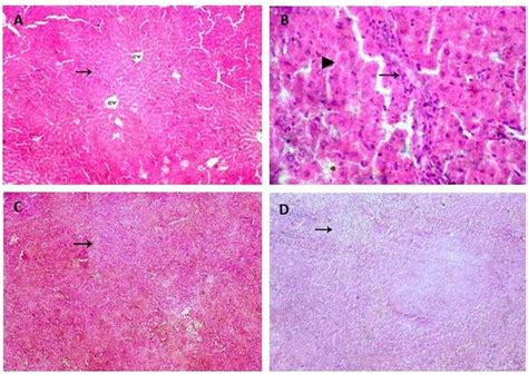 Hepatic histopathology A) The micrograph of the control group shows ...