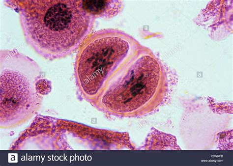 Prophase Plant Cell Microscope