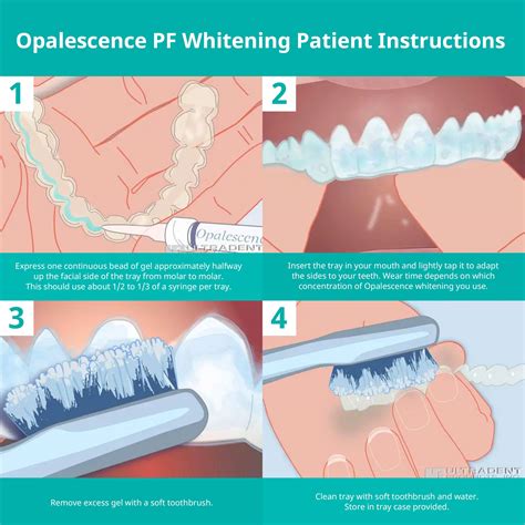 Buy Opalescence At Home Teeth Whitening Teeth Whitening Gel Syringes