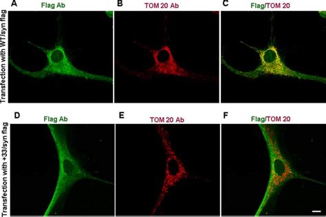 Mitochondrial Localization Of Wt Synuclein And 33 Synuclein By