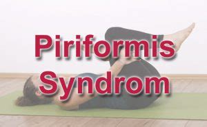 Piriformis Syndrom wirksame Sofort Übungen Test