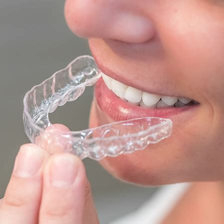 Maya Aligner CONTENTIE Clinicile DR ALECU