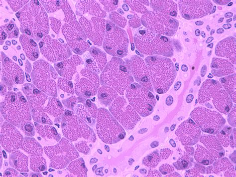 pancreatic acinar cells