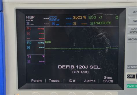 Zoll M Series Cct Biphasic J Defibrillator Monitor Ecg Masimo Spo